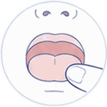 Esercizio dopo frenulectomia linguale Esercizio dopo frenulectomia linguale